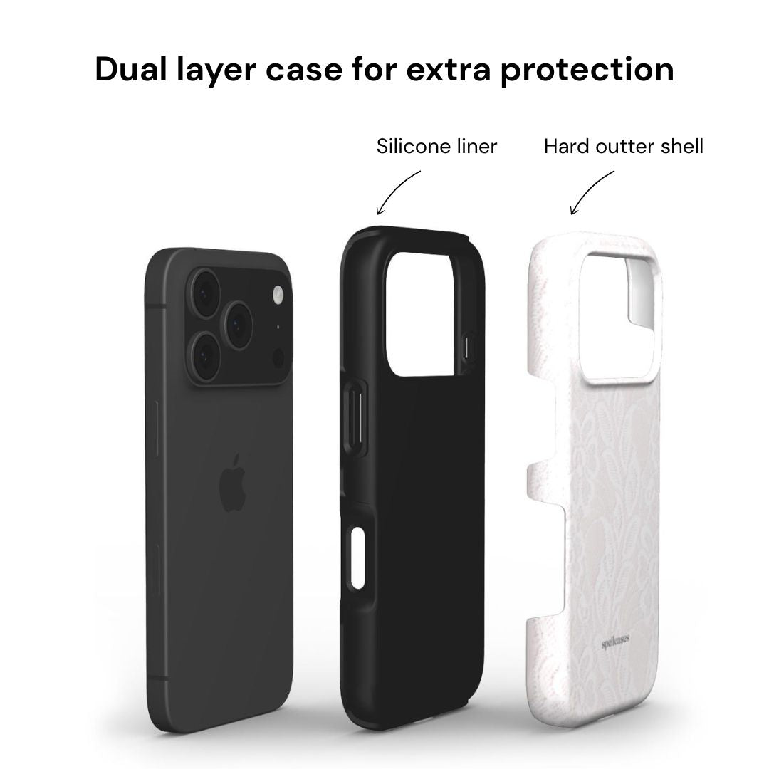 White Lace iPhone Case